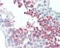 MEPCE Antibody (Internal)